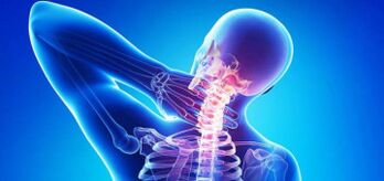 príčiny krčnej osteochondrózy
