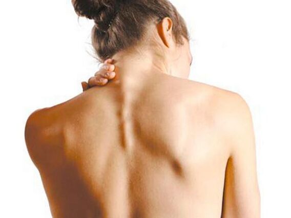 Dievča má cervikálnu osteochondrózu