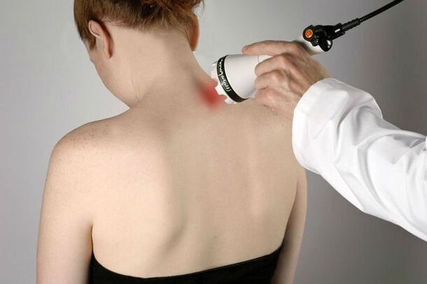 fyzioterapeutické opatrenia na liečbu cervikálnej osteochondrózy