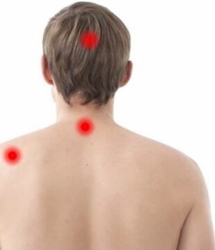 miesto bolesti pri cervikálnej osteochondróze