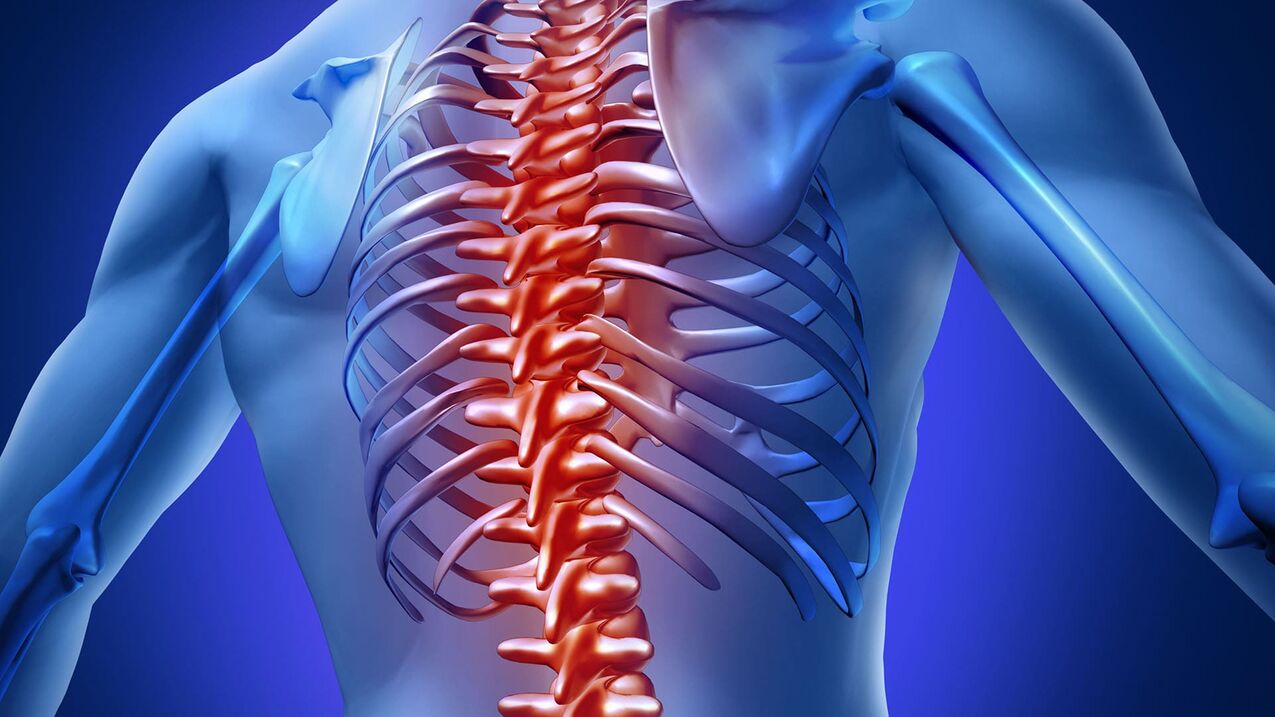 Hrudná osteochondróza